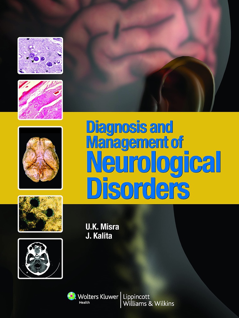 Diagnosis and Management of Neurological Disorders