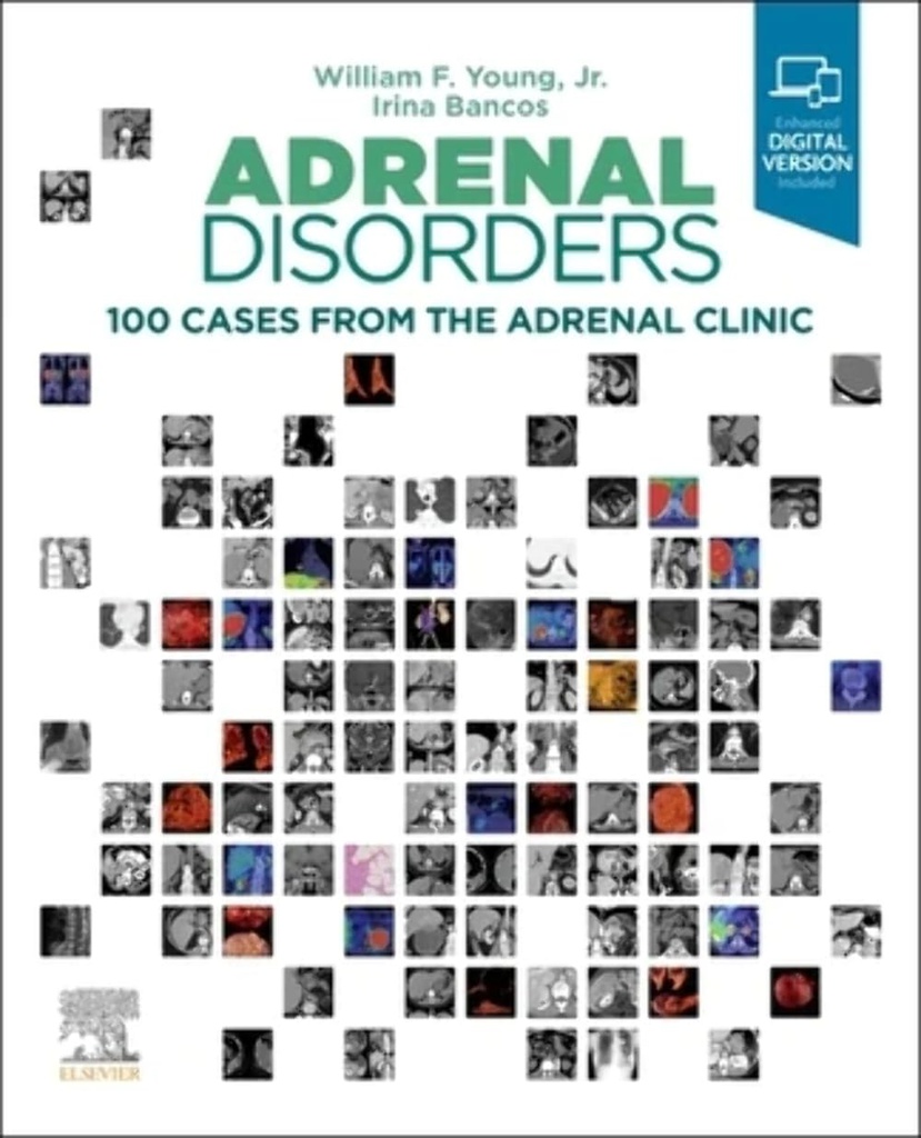 Adrenal Disorders: 100 Cases from the Adrenal Clinic 1ed