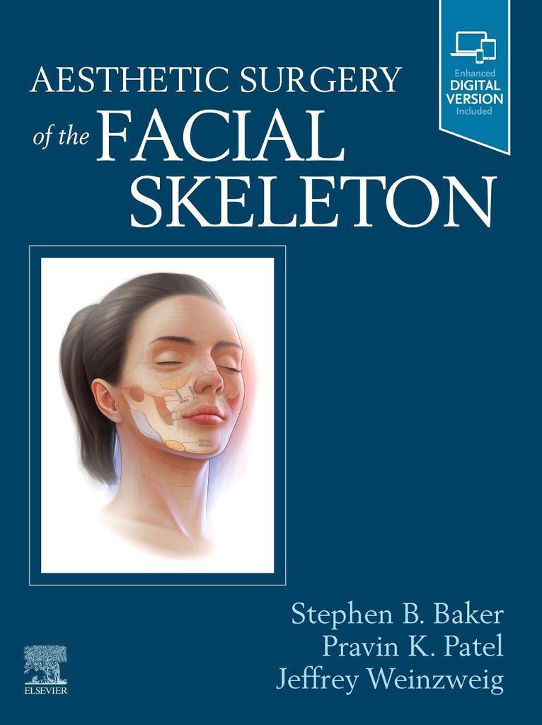 Aesthetic Surgery of the Facial Skeleton: 1ed