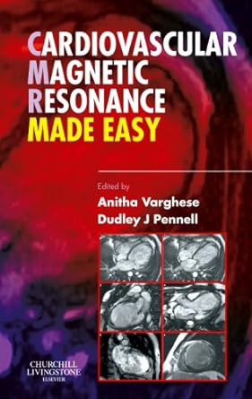 Cardiovascular Magnetic Resonance Made Easy: 1ed