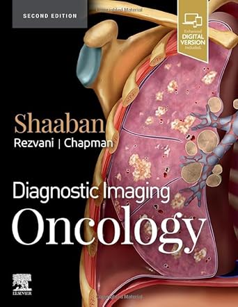 Diagnostic Imaging: Oncology: 2ed