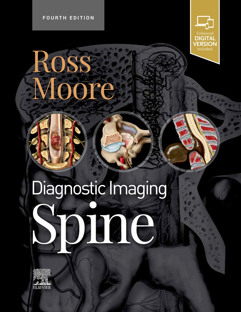 Diagnostic Imaging: Spine:4ed 