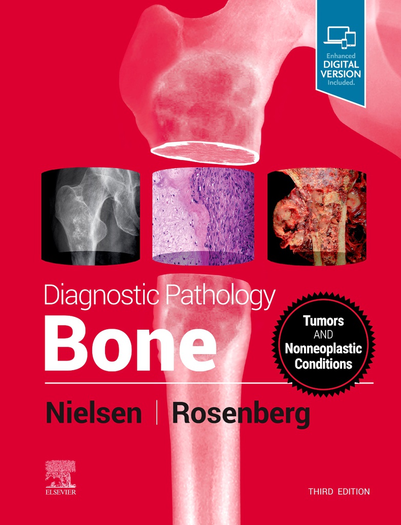 Diagnostic Pathology: Bone, 3/e