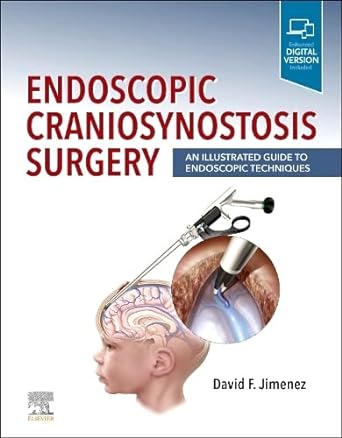 Endoscopic Craniosynostosis Surgery: An Illustrated Guide to Endoscopic Techniques 1ed