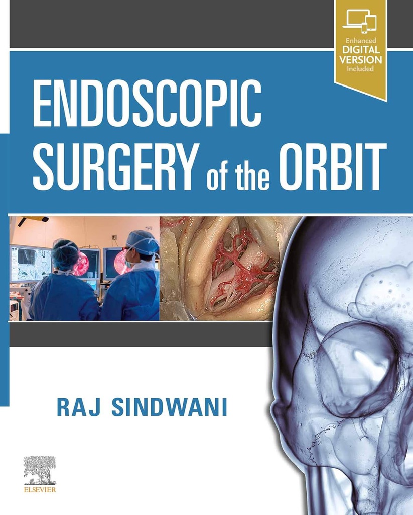 Endoscopic Surgery of the Orbit: 1ed