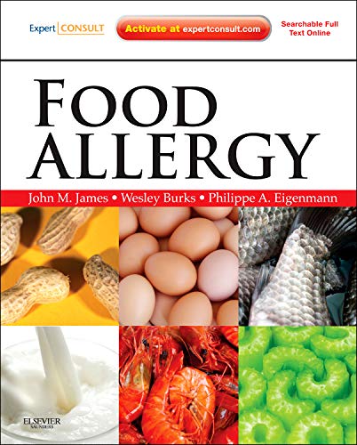 Food Allergy: Expert Consult Basic 1ed