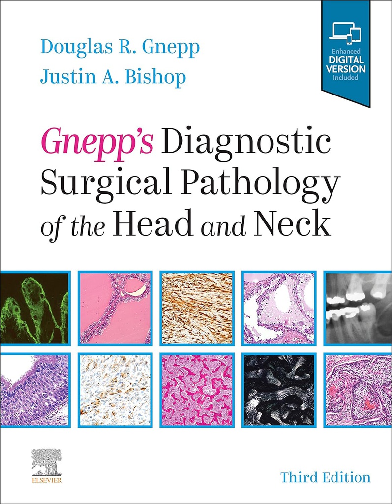 Gnepp's Diagnostic Surgical Pathology of the Head and Neck: 3ed