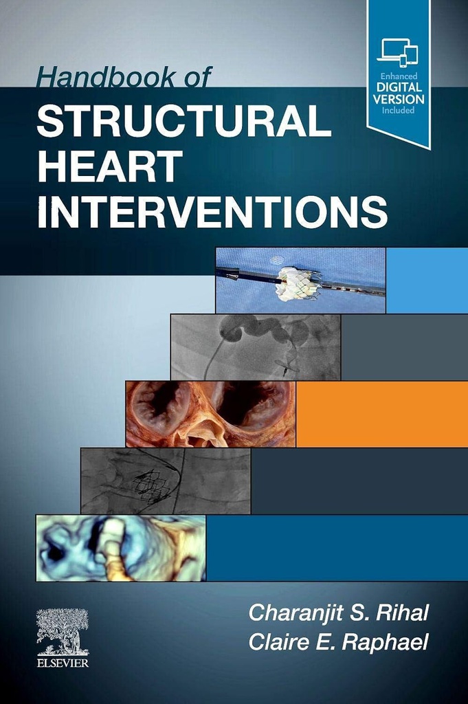 Handbook of Structural Heart Interventions: 1ed