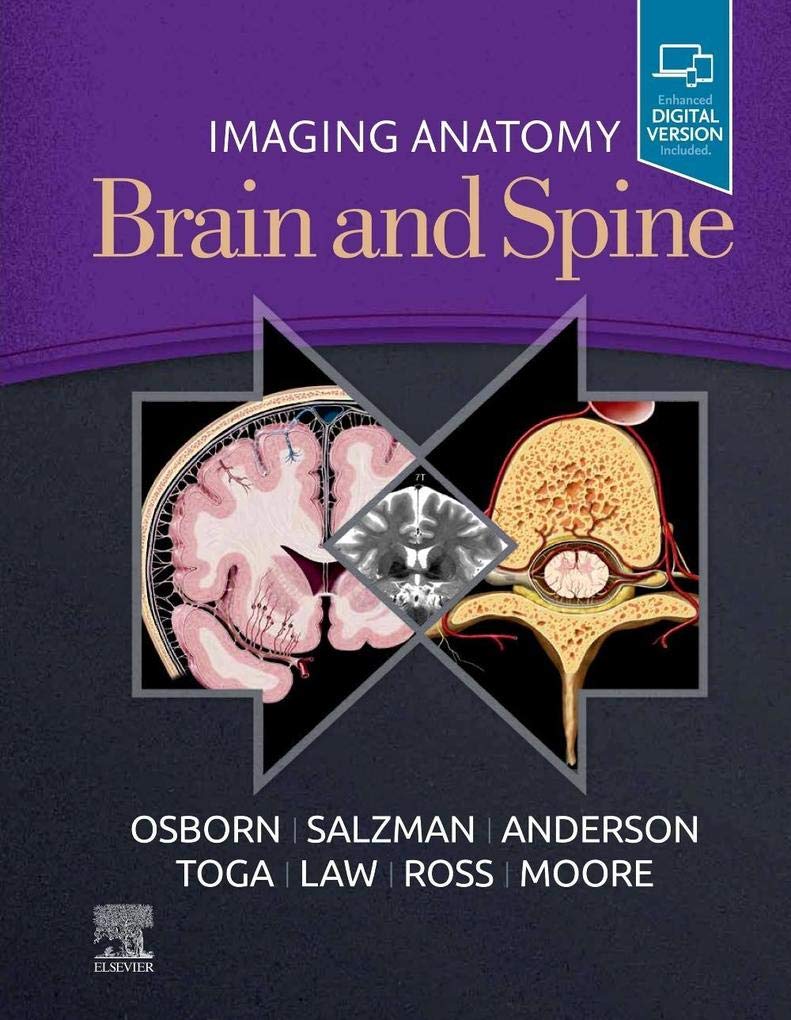 Imaging Anatomy Brain and Spine: 1ed