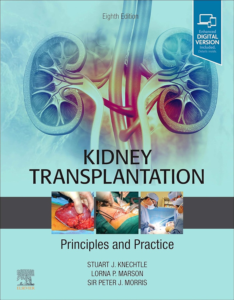 Kidney Transplantation - Principles and Practice: 8ed