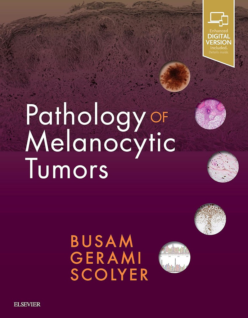 Pathology of Melanocytic Tumors: 1ed