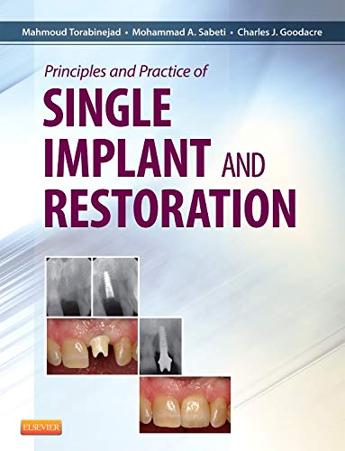 Principles and Practice of Single Implant and Restoration: 1ed