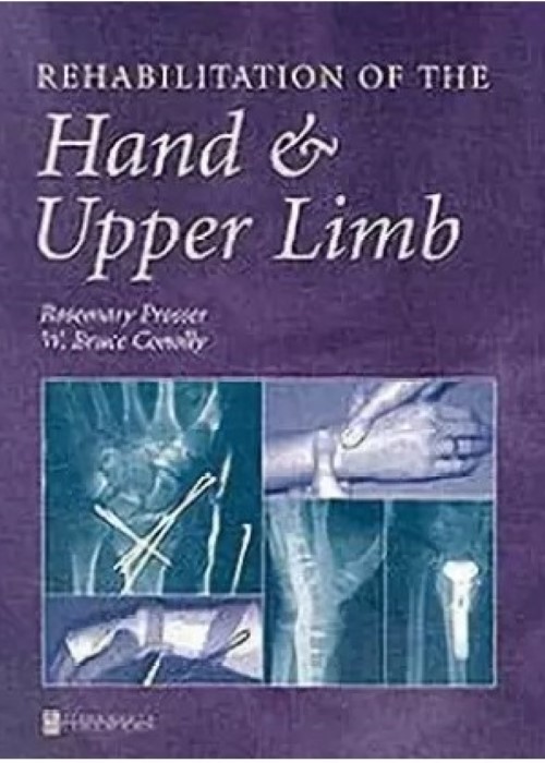 Rehabilitation of the Hand and Upper Limb: 1ed