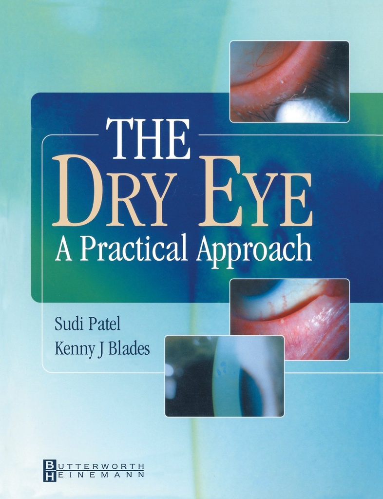 The Dry Eye: A Practical Approach 1ed