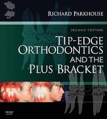 Tip-Edge Orthodontics and the Plus Bracket: 2ed