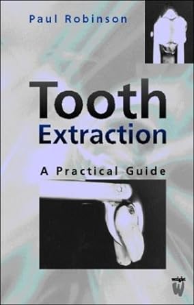 Tooth Extraction: A Practical Guide 1ed