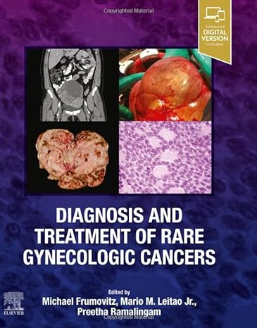 Diagnosis and Treatment of Rare Gynecologic Cancers: 1ed