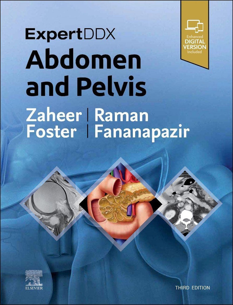 ExpertDDx: Abdomen and Pelvis: 3ed