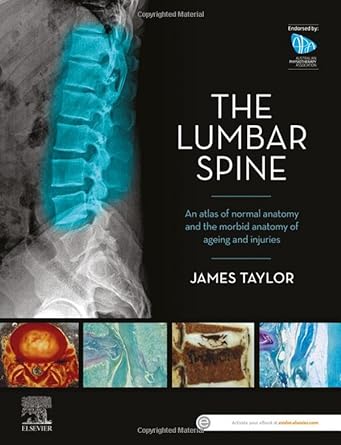 The Lumbar Spine: An Atlas of Normal Anatomy and the Morbid Anatomy of Ageing and Injury 1ed