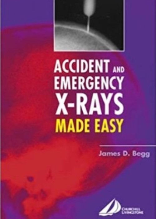 Accident and Emergency X-Rays Made Easy: 1ed