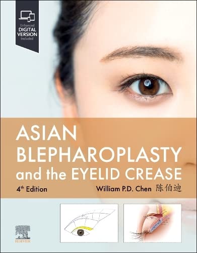 Asian Blepharoplasty and the Eyelid Crease: 4ed