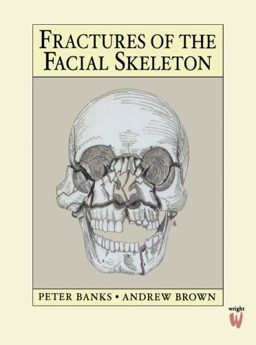 Fractures of the Facial Skeleton: 1ed