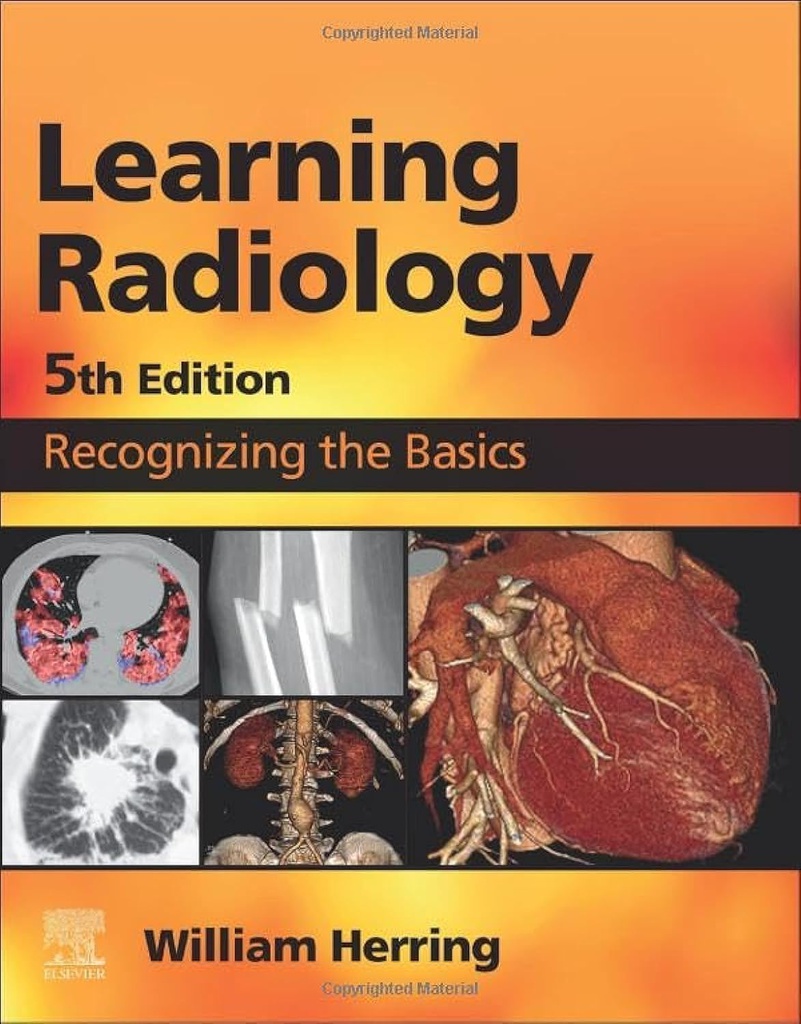 Learning Radiology: Recognizing the Basics 5ed