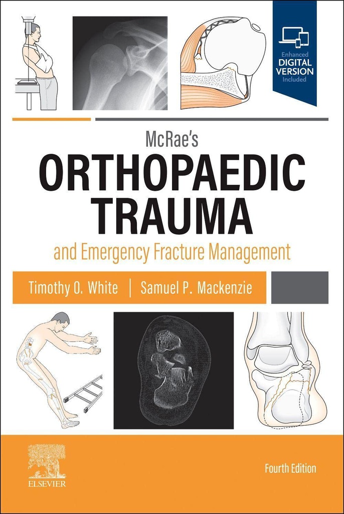 McRae's Orthopaedic Trauma and Emergency Fracture Management: 4ed