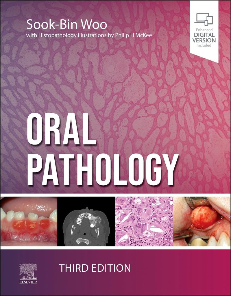 Oral Pathology: 3ed