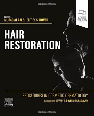 Procedures in Cosmetic Dermatology: Hair Restoration: 1ed