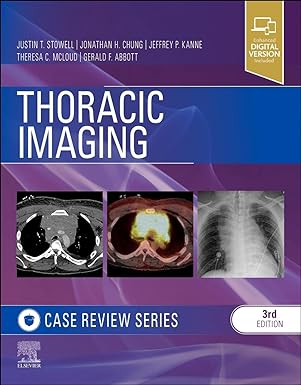 Thoracic Imaging: Case Review: 3ed