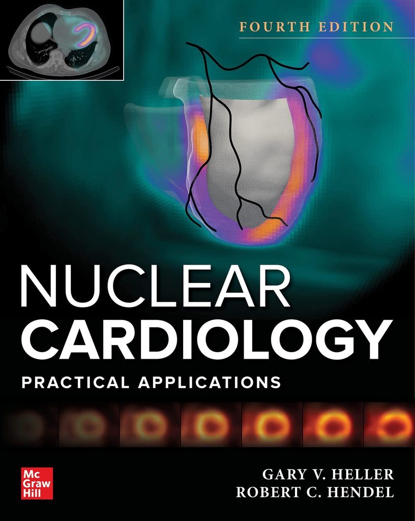 NUCLEAR CARDIOLOGY: PRACTICAL APPLICATIONS 4E