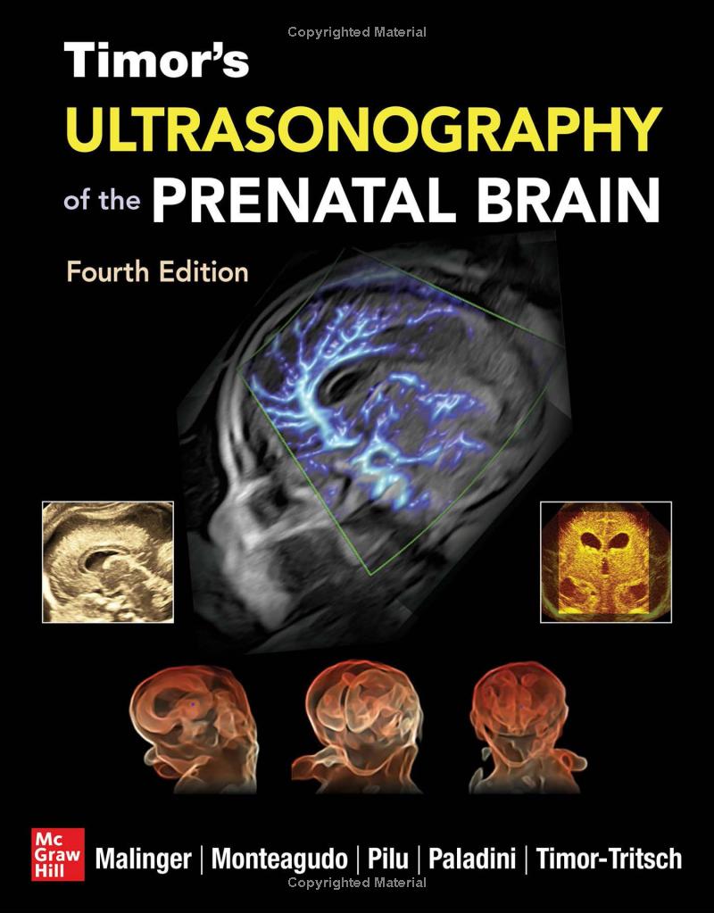 ULTRASONOGRAPHY OF THE PRENATAL BRAIN