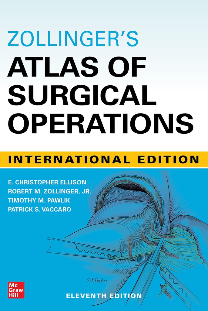 ZOLLINGER'S ATLAS OF SURGICAL OPERATIONS, 11E (IE)