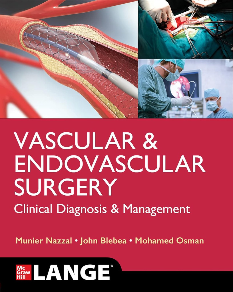 LANGE VASCULAR AND ENDOVASCULAR SURGERY: CLINICAL DIAGNOSIS & MANAGEMENT