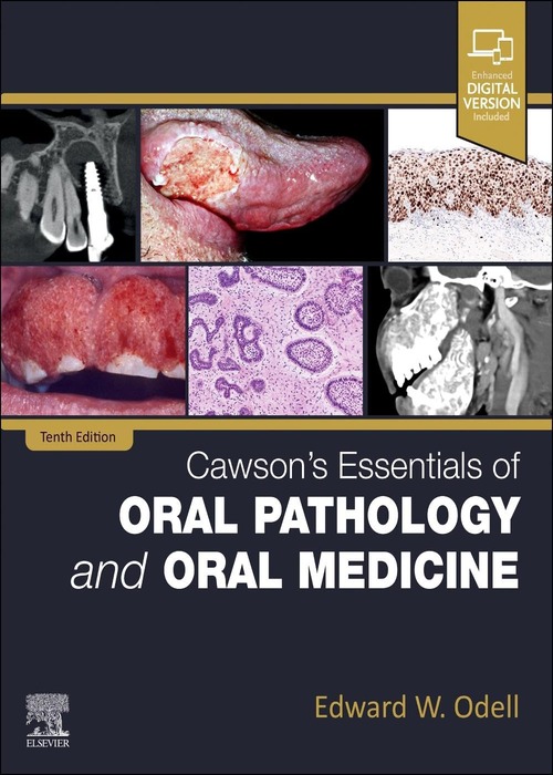 Cawson's Essentials of Oral Pathology and Oral Medicine: 10ed