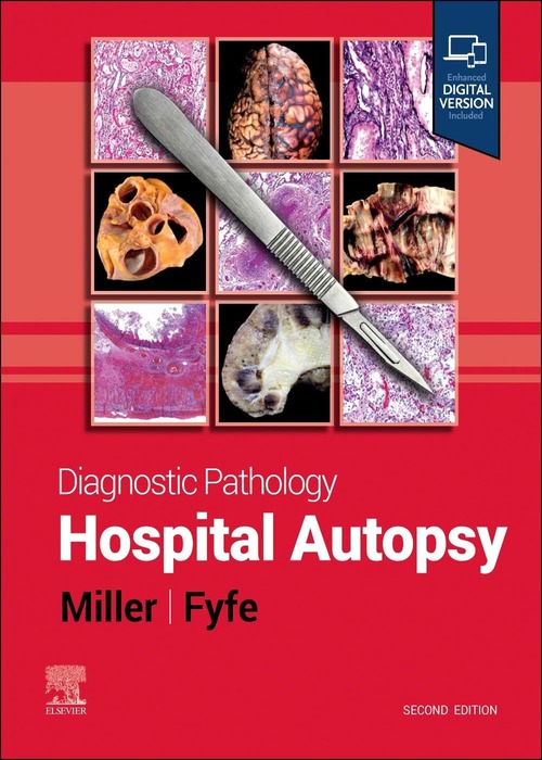 Diagnostic Pathology: Hospital Autopsy: 2ed