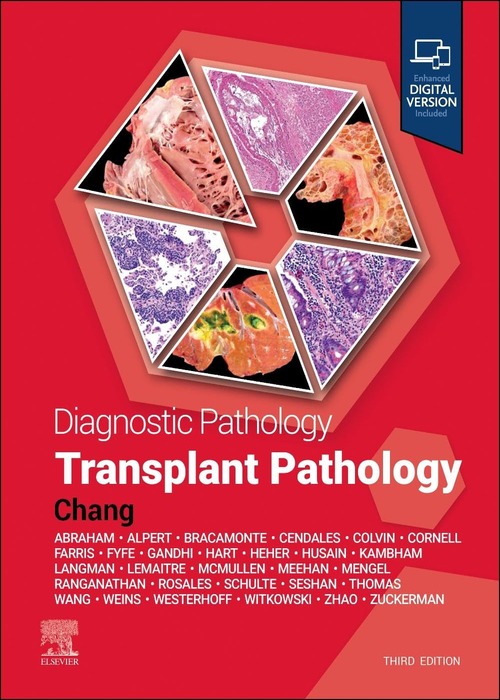 Diagnostic Pathology: Transplant Pathology: 3ed