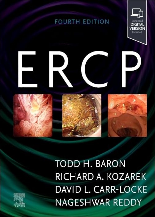 ERCP: 4ed