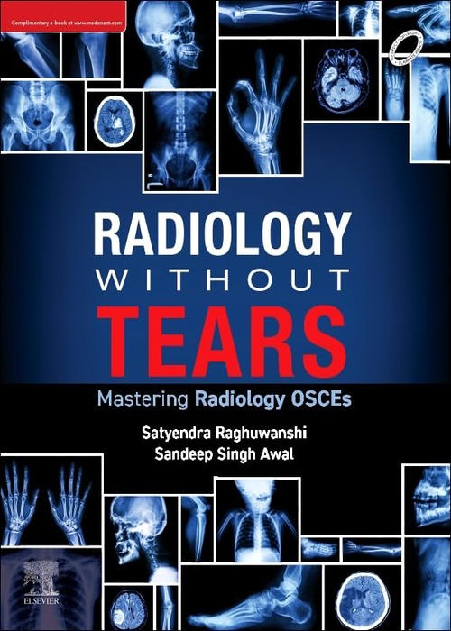 Radiology Without Tears: Mastering Radiology OSCEs