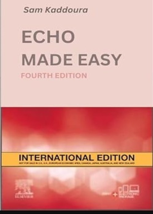 Echo Made Easy IE: 4ed