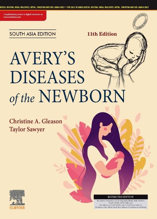 Averys Diseases of the Newborn, 11/e-SAE