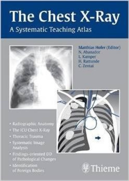 The Chest X-Ray: A Systematic Teaching Atlas (Asian Edition)
