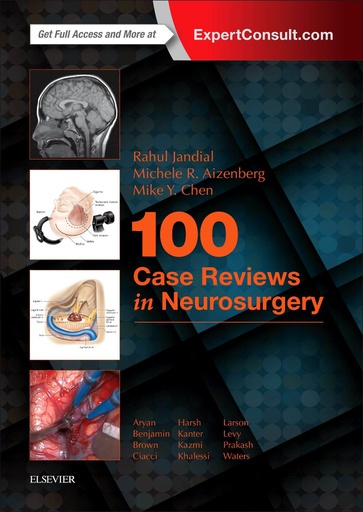 [B9780323356374] 100 Case Reviews in Neurosurgery: 1ed