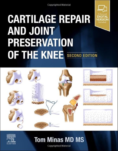 [B9780323698085] Cartilage Repair and Joint Preservation of the Knee: 2ed