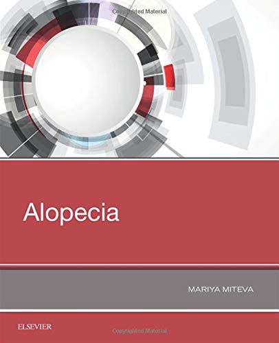 [B9780323548250] Alopecia: 1ed