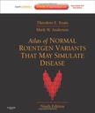 Atlas of Normal Roentgen Variants That May Simulate Disease: Expert Consult - Enhanced Online Features and Print 9ed