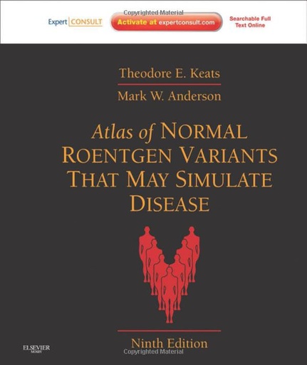 [B9780323073554] Atlas of Normal Roentgen Variants That May Simulate Disease: Expert Consult - Enhanced Online Features and Print 9ed