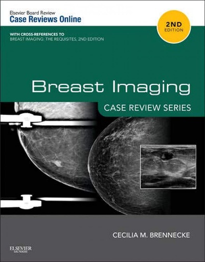 [B9780323087223] Breast Imaging: Case Review Series: 2ed