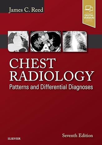 [B9780323498319] Chest Radiology: Patterns and Differential Diagnoses 7ed